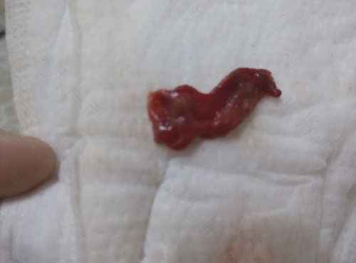 50岁月经推迟不来什么原因 50岁月经推迟不来什么原因