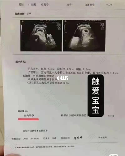 多囊卵巢会肚子疼吗 多囊卵巢会肚子疼吗