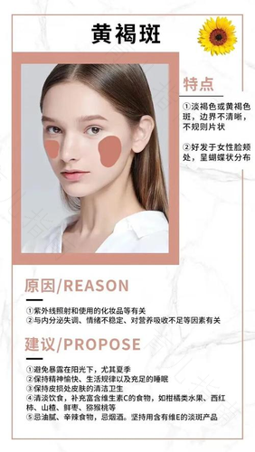内分泌失调会长斑吗 内分泌失调会长斑吗