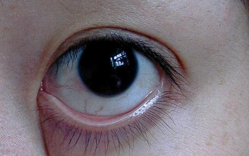 感觉眼球跳动怎么回事 感觉眼球跳动怎么回事