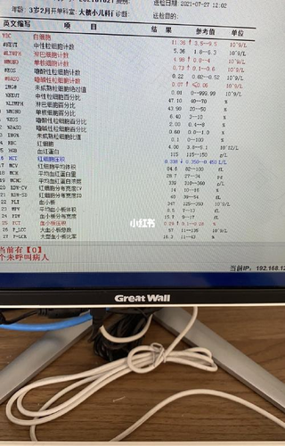 得了百日咳后怎么治疗 得了百日咳后怎么治疗
