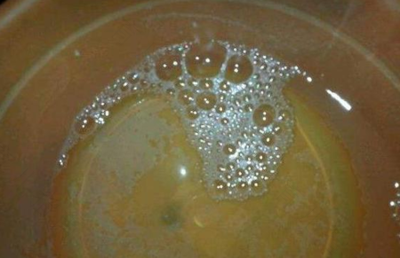 小便有气泡怎么回事男