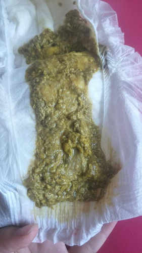 肚子绞痛拉稀怎么回事都三天了 肚子绞痛拉稀怎么回事都三天了