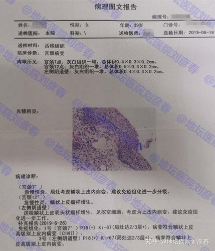 检查宫颈需要做什么检查