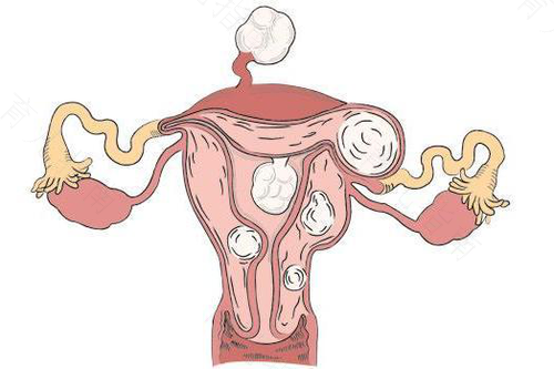 宫颈口太低会有什么影响 宫颈口太低会有什么影响