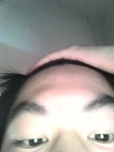 为什么额头上有两个凸起的骨头 为什么额头上有两个凸起的骨头