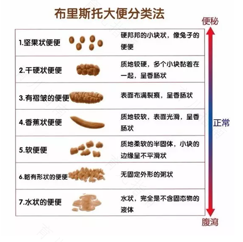经常大便稀怎么治疗 经常大便稀怎么治疗