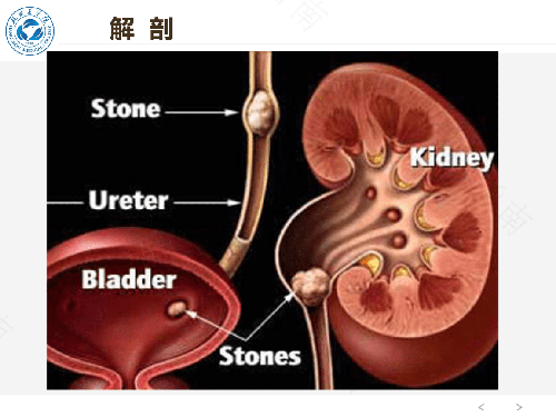 b超憋尿会引起肾积水吗