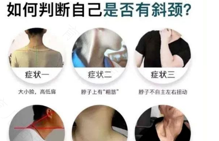 脖子偏向一边疼怎么办 脖子偏向一边疼怎么办