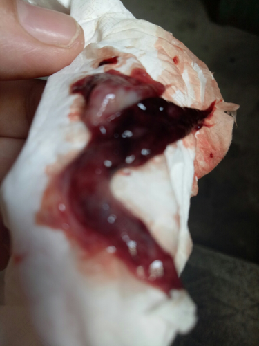 一个月来两次月经怎么办? 一个月来两次月经怎么办?