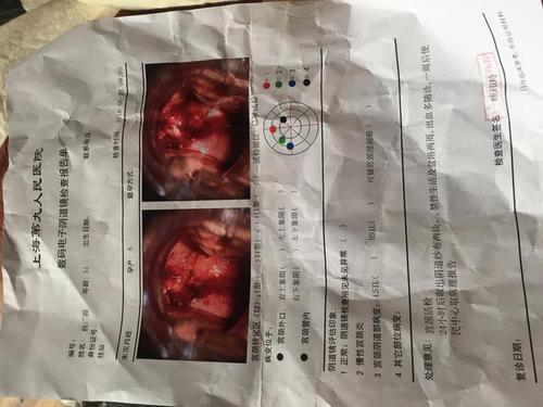 慢性子宫颈炎症的主要症状是 慢性子宫颈炎症的主要症状是