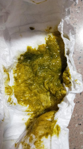 六个月的宝宝拉肚子次数多怎么办 六个月的宝宝拉肚子次数多怎么办