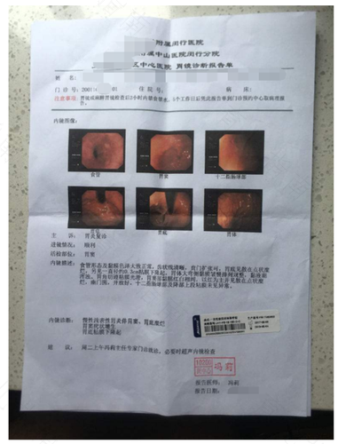 功能性肠胃炎的症状和原因