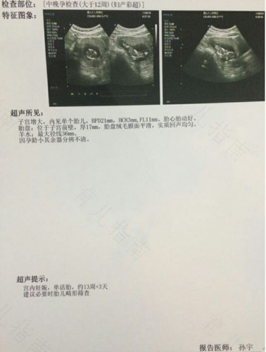 多囊是不是治不好了呢