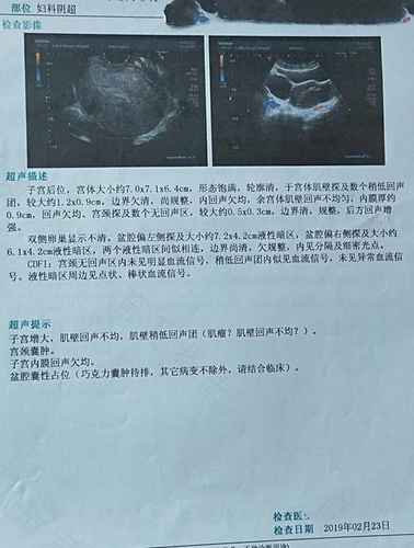 子宫一直在流血怎么办 子宫一直在流血怎么办