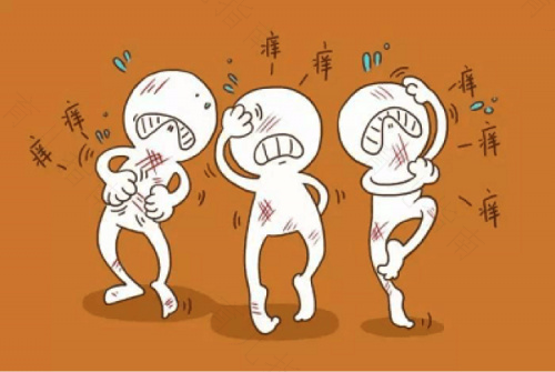 痔疮会痒吗肛门瘙痒是痔疮吗 痔疮会痒吗肛门瘙痒是痔疮吗