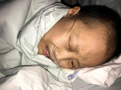 白血病前一天死的症状 白血病前一天死的症状