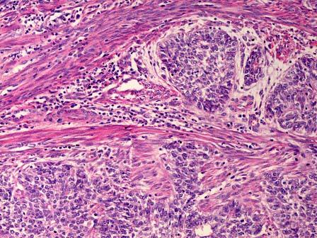 不规则子宫出血的原因