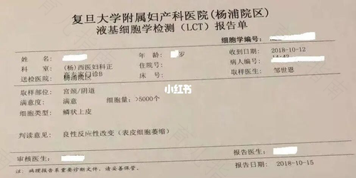 TCT检查需要空腹吗? TCT检查需要空腹吗?