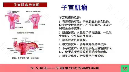 绝经后还会长子宫息肉吗 绝经后还会长子宫息肉吗