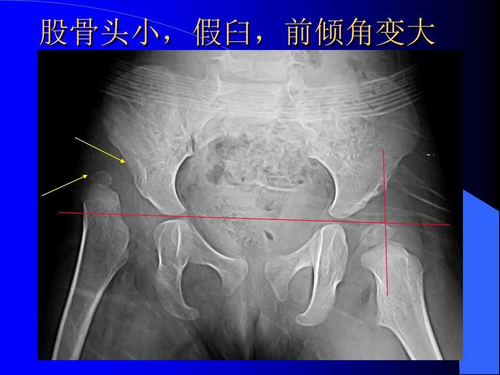 发育不良怎么办?