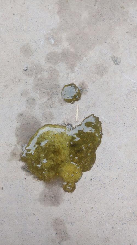 拉肚子挂什么科室 拉肚子挂什么科室