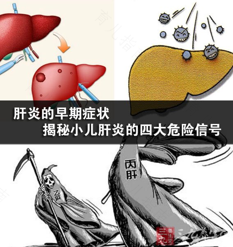 急性乙肝炎会传染吗 急性乙肝炎会传染吗