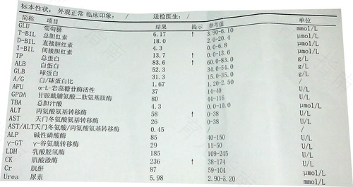 肝功能球蛋白偏高是怎么回事 肝功能球蛋白偏高是怎么回事