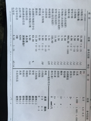 尿常规能检查出什么病 尿常规能检查出什么病