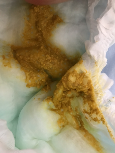 宝宝拉肚子一天拉六七次怎么办 宝宝拉肚子一天拉六七次怎么办