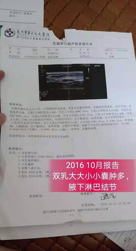 乳腺囊肿是什么原因引起的 乳腺囊肿是什么原因引起的