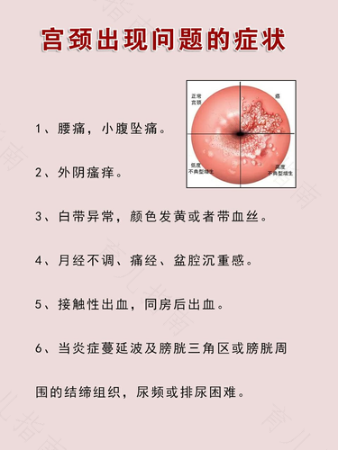 宫颈炎出血什么颜色 宫颈炎出血什么颜色