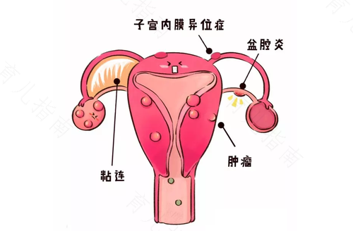 宫颈口有点疼是怎么回事 宫颈口有点疼是怎么回事