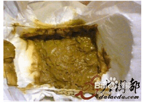 大便量少但次数多怎么办 大便量少但次数多怎么办