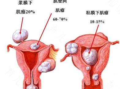 宫颈不受力什么意思 宫颈不受力什么意思