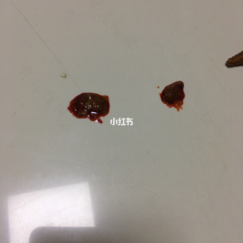 肠炎拉屎出血怎么办 肠炎拉屎出血怎么办