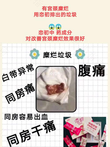 宫颈发白是什么原因引起的 宫颈发白是什么原因引起的