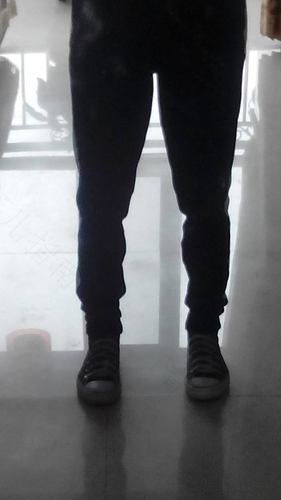 小腿有点罗圈腿怎么办 小腿有点罗圈腿怎么办