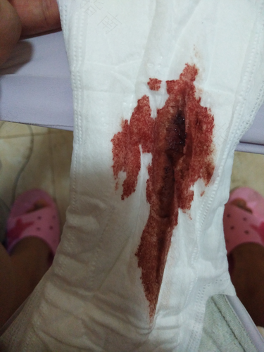 月经颜色浅是怎么回事 月经颜色浅是怎么回事