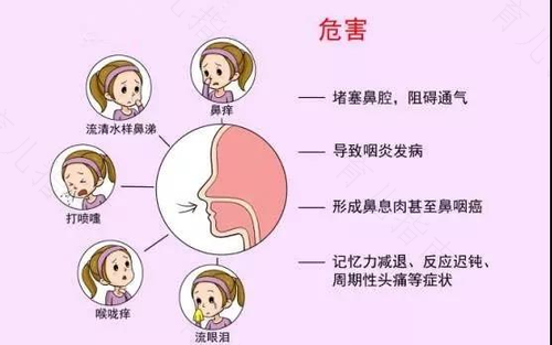 鼻炎引起长期咳嗽 鼻炎引起长期咳嗽