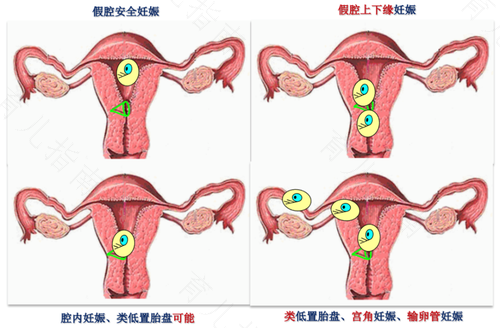 子宫刀口薄怎么办可以长厚 子宫刀口薄怎么办可以长厚
