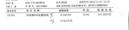 eb病毒结果怎么看 吃什么药 eb病毒结果怎么看 吃什么药