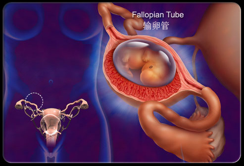 子宫有点刺疼是为什么 子宫有点刺疼是为什么