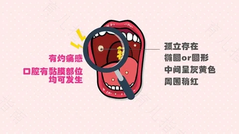 总起口腔溃疡怎么回事儿 总起口腔溃疡怎么回事儿