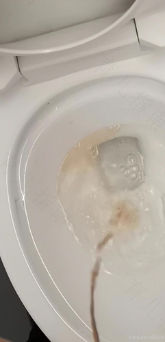 老年人女性尿血是什么原因引起的 老年人女性尿血是什么原因引起的