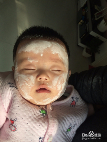 婴儿长湿疹怎么办 婴儿长湿疹怎么办