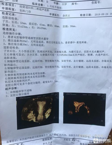 输卵管不通畅的症状 输卵管不通畅的症状