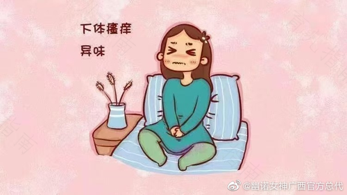 外阴干涩痒痛用什么药 外阴干涩痒痛用什么药