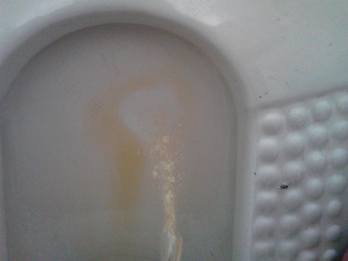 小便长期发黄怎么办 小便长期发黄怎么办