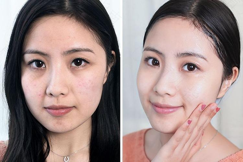 22岁皮肤松弛怎么解决 22岁皮肤松弛怎么解决